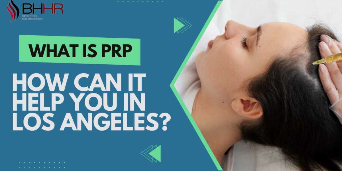 Benefits of PRP Hair Los Angeles